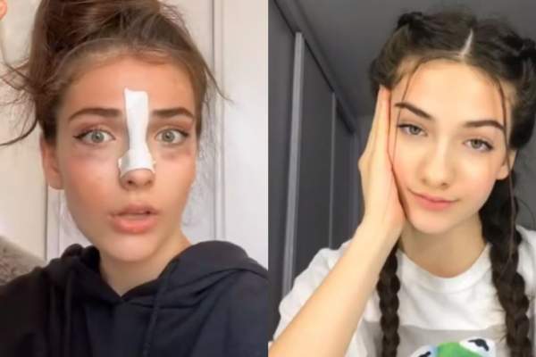Andreea Bostănică, supranumită „Regina TikTok-ului” și-a operat nasul. Cum arăta tânăra înainte de intervenție / FOTO