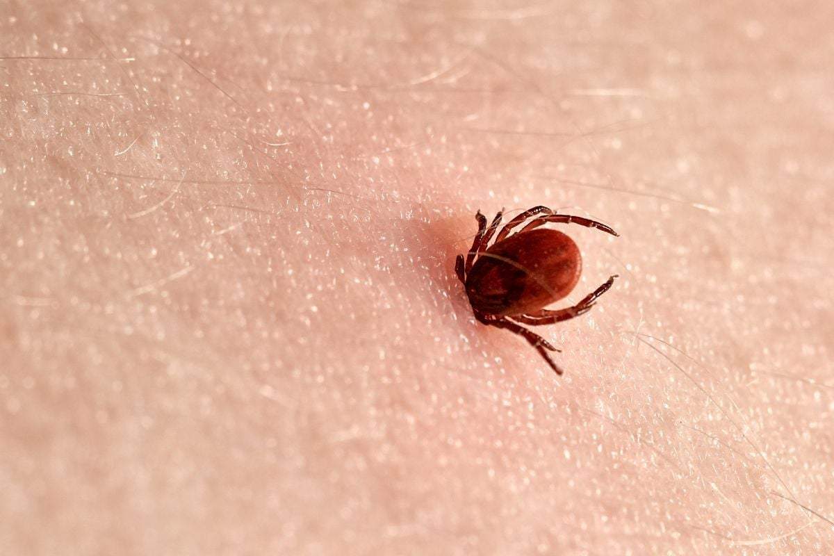 Mușcătură căpușă Ce să faci dacă ai resturi de căpușă în piele. Cum le îndepărtezi ca să nu riști o infecție
