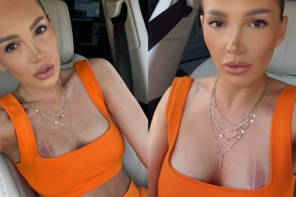 Iulia Sălăgean s-a ars pe corp! Ce i s-a întâmplat fostei soții a lui Alex Bodi: ''Eram dezbrăcată...”
