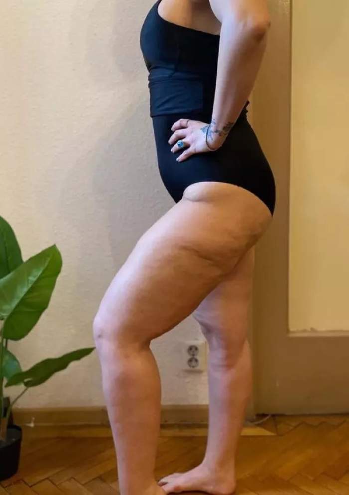 Cum a reușit Oana Radu să nu mai cântărească 120 de kilograme. Imagini înainte și după ce a slăbit: "Sunt urmele pe care..."