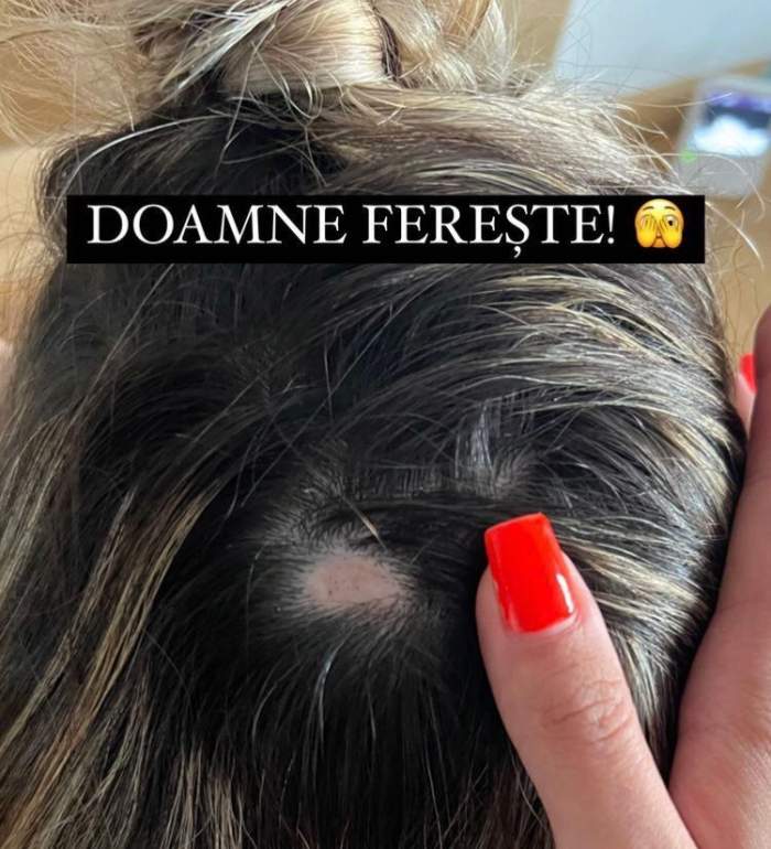 Fotografia cu care iubita lui Cristian Manea și-a îngrijorat fanii. Și Kourtney Kardashian a pățit același lucru: ”Sunt traumatizată” / FOTO