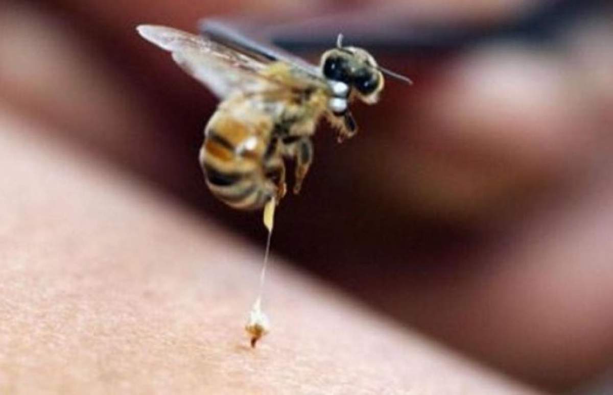 Ce trebuie să faci atunci când te înțeapă o albină. Dr. Tudor Ciuhodaru, zece sfaturi care îți pot salva viaţa