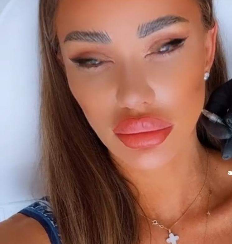 Bianca Drăgușanu, din nou în cabinetul medicilor esteticieni. Ce schimbări își face diva sexy / FOTO