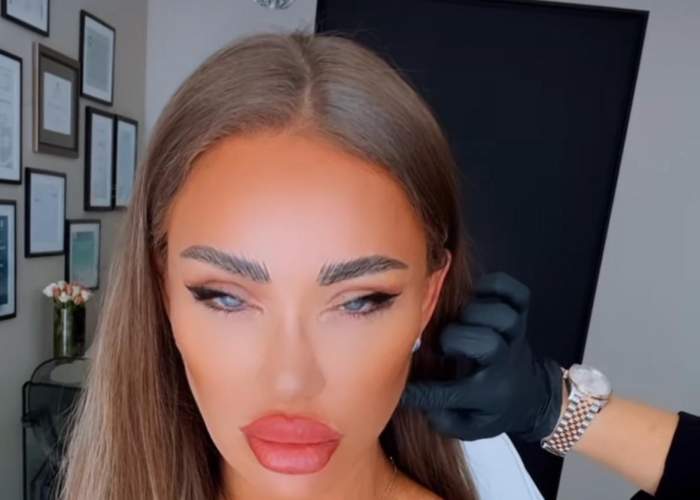 Bianca Drăgușanu, din nou în cabinetul medicilor esteticieni. Ce schimbări își face diva sexy / FOTO