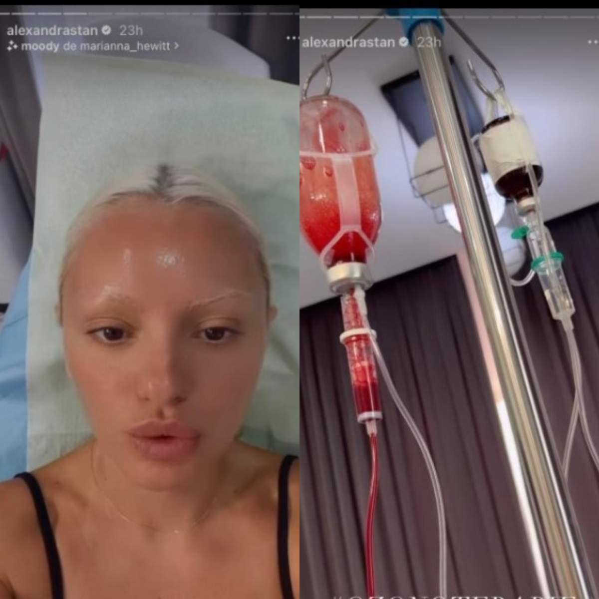 Alexandra Stan a ajuns pe mâna medicilor, după vacanța din Grecia. Ce a pățit artista: “Am probleme cu…” / FOTO