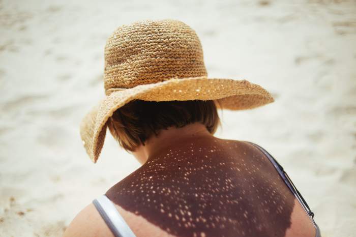 De ce e bine să iei vitamina D când stai pe plajă, la mare. Explicația medicilor