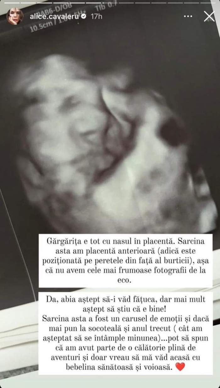 Alice Cavaleru, prima imagine cu chipul bebelușului. Soția lui Vladimir Drăghia este însărcinată în luna a 9-a / FOTO