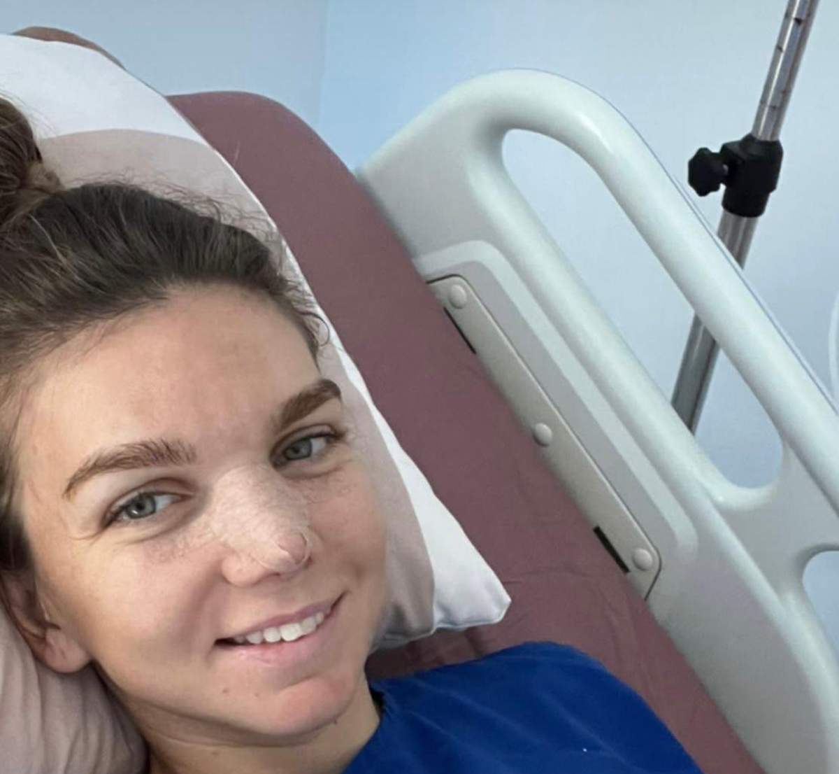 Simona Halep, operație estetică după divorț. La ce intervenție a aplelat