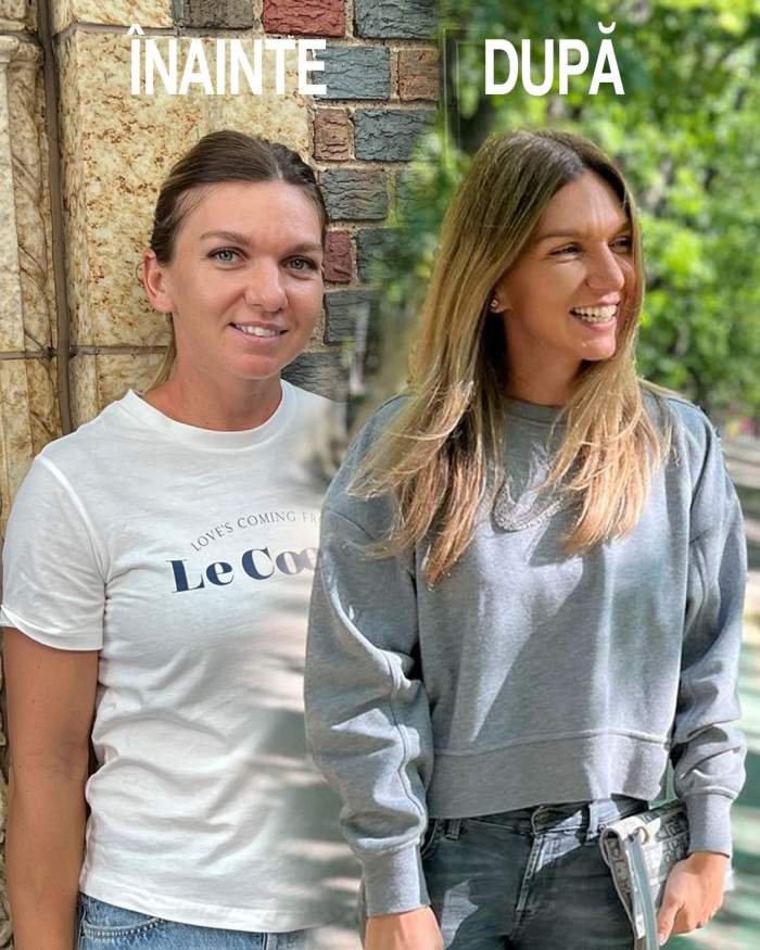 Simona Halep, primele imagini după cele două intervenții suferite la nas. Cum s-a postat jucătoarea de tenis la scurt timp de la operație