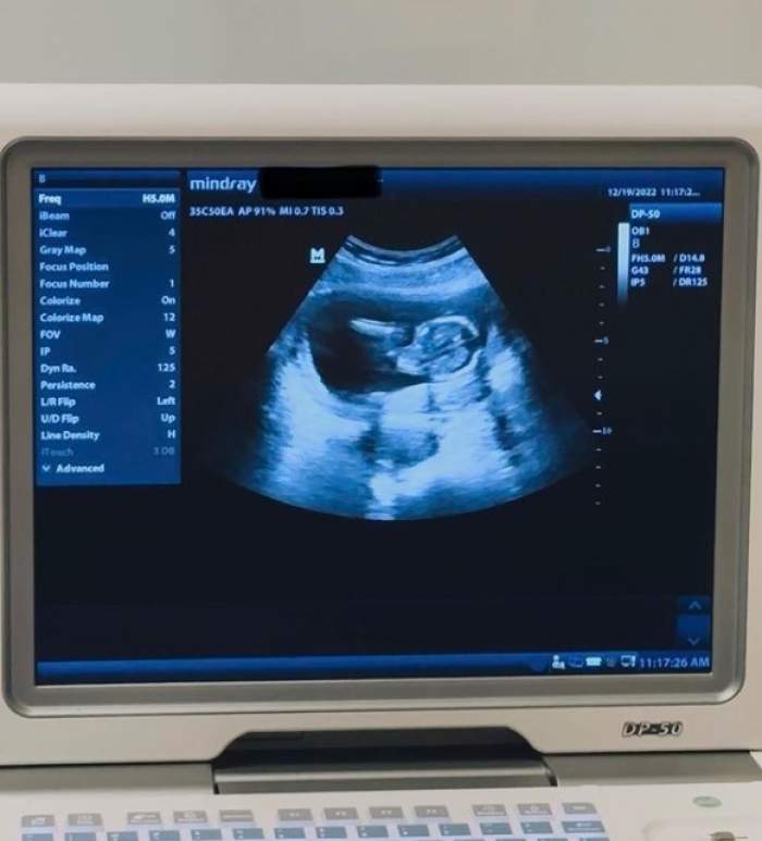 Alec Baldwin va deveni bunic pentru prima oară. Fiica lui cea mare a anunțat sarcina la doar 3 luni de când actorul i-a dăruit încă un frate