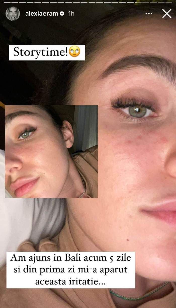 Alexia Eram, probleme de sănătate în vacanța din Bali. Cu ce s-a confruntat vedeta în destinația exotică: ”Din prima zi mi-a apărut” / FOTO