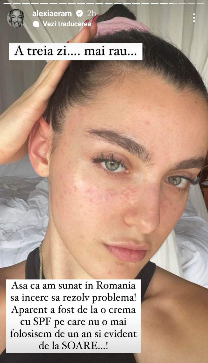 Alexia Eram, probleme de sănătate în vacanța din Bali. Cu ce s-a confruntat vedeta în destinația exotică: ”Din prima zi mi-a apărut” / FOTO