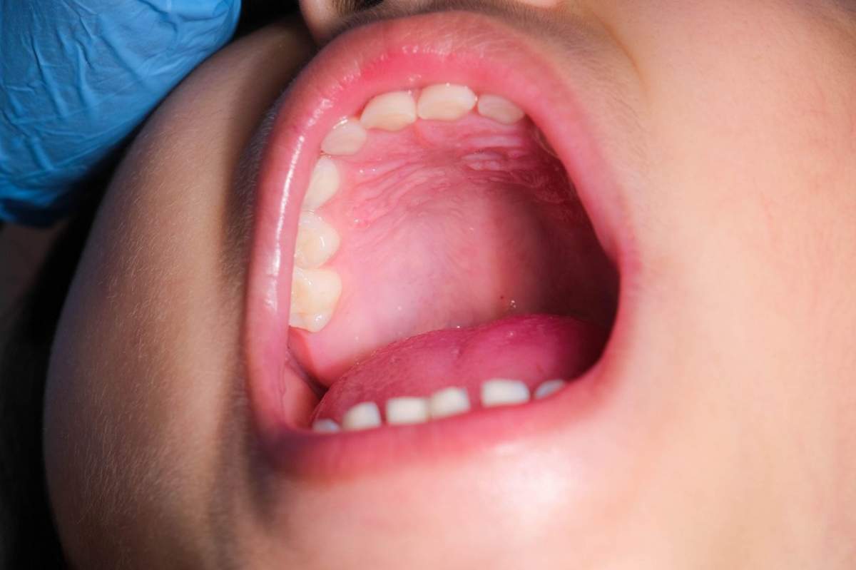 Prim-plan al palatului dur din gura unui copil sănătos cu rânduri frumoase de dinți de lapte