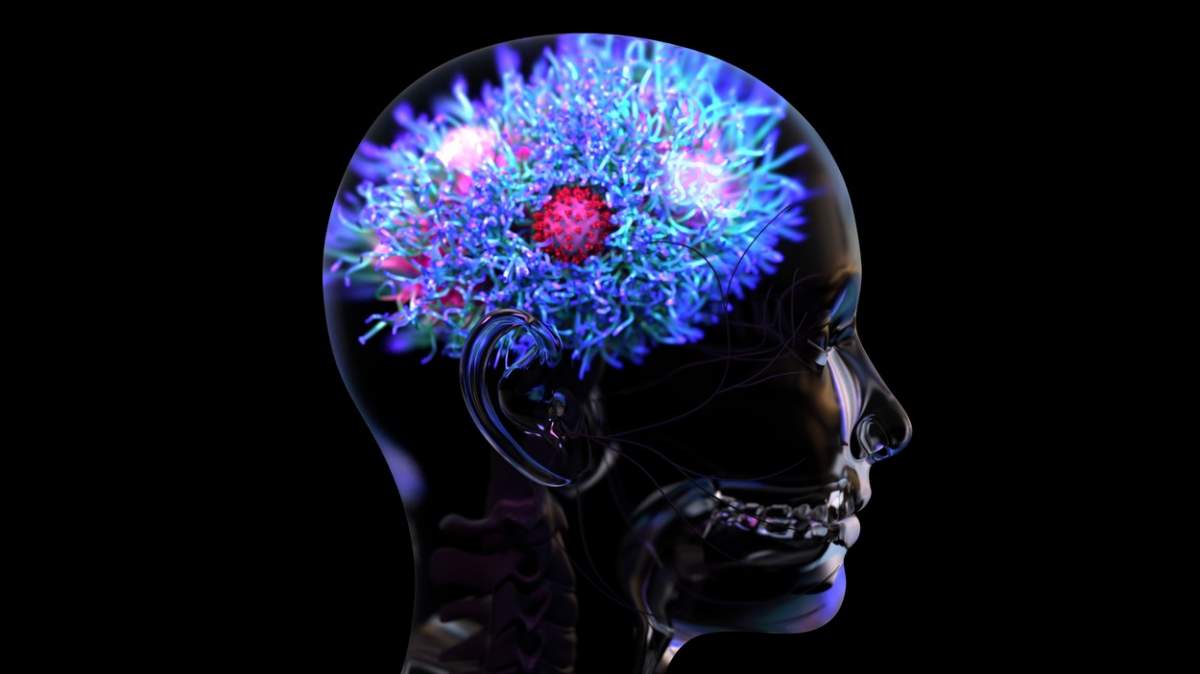 Cum afectează COVID-19 creierul uman