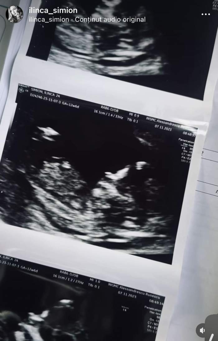 Ilinca Simion, imagini emoționante cu burtica de gravidă și ecografiile bebelușului. Postările speciale făcute de soția lui George Simion / VIDEO