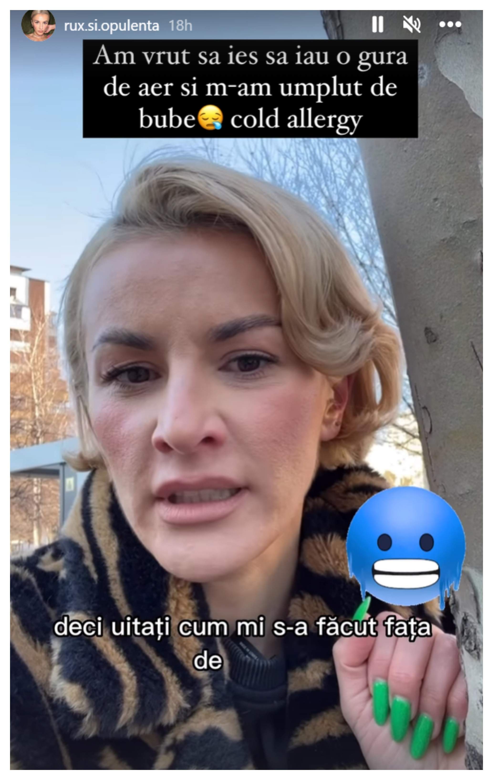 Ruxi Opulenta, plină de bube pe rețelele de socializare. Influencerița nu vrea să meargă la medic: ”Să găsiți pe altcineva” / VIDEO