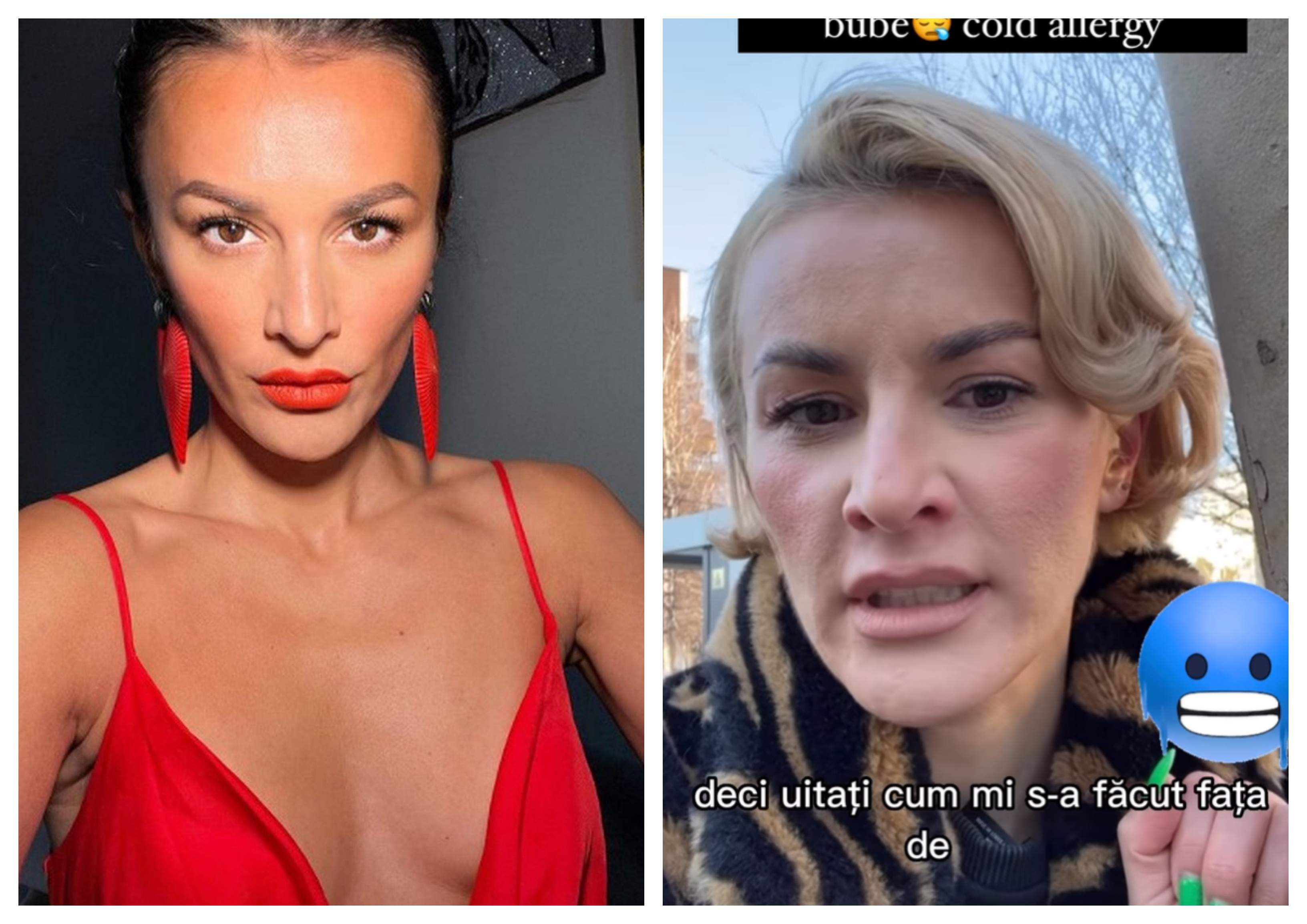 Ruxi Opulenta, plină de bube pe rețelele de socializare. Influencerița nu vrea să meargă la medic: ”Să găsiți pe altcineva” / VIDEO