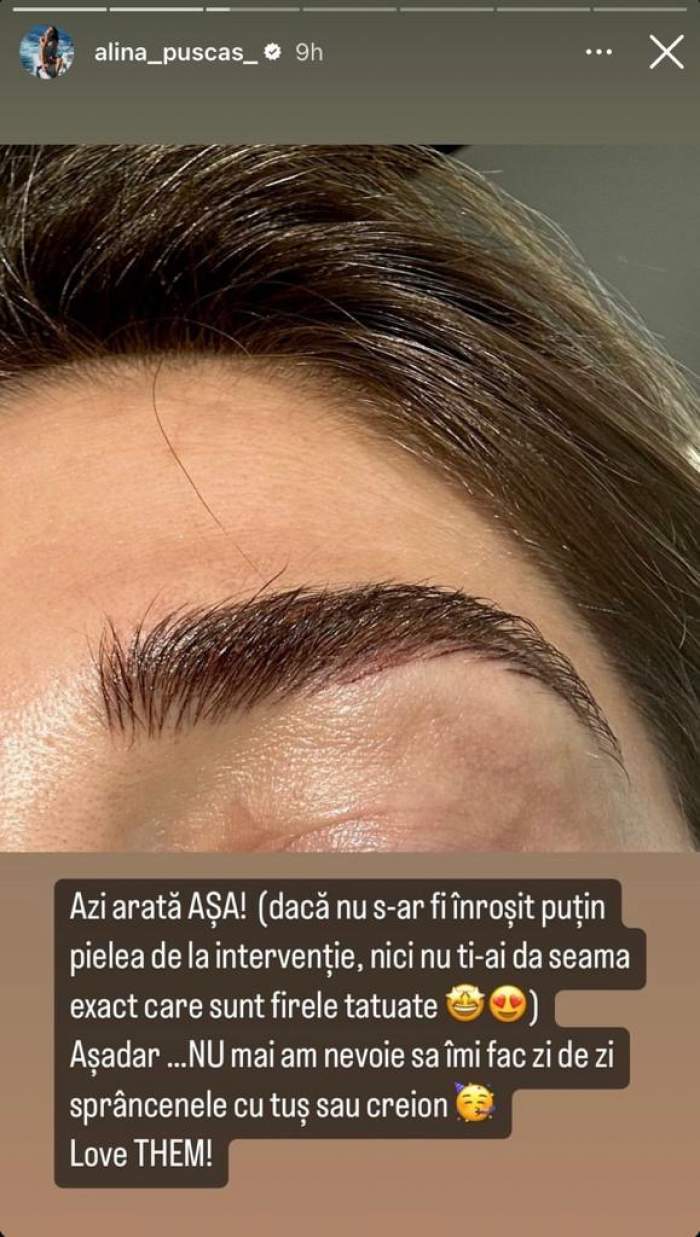 La ce procedură a apelat Alina Pușcaș la nivelul feței. Cum arată acum prezentatoarea TV: "Am avut și eu nevoie” / FOTO