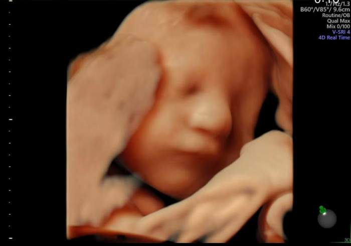 Andreea Popescu, prima imagine cu chipul bebelușului din burtică. Vedeta urmează să devină mamă pentru a treia oară / FOTO