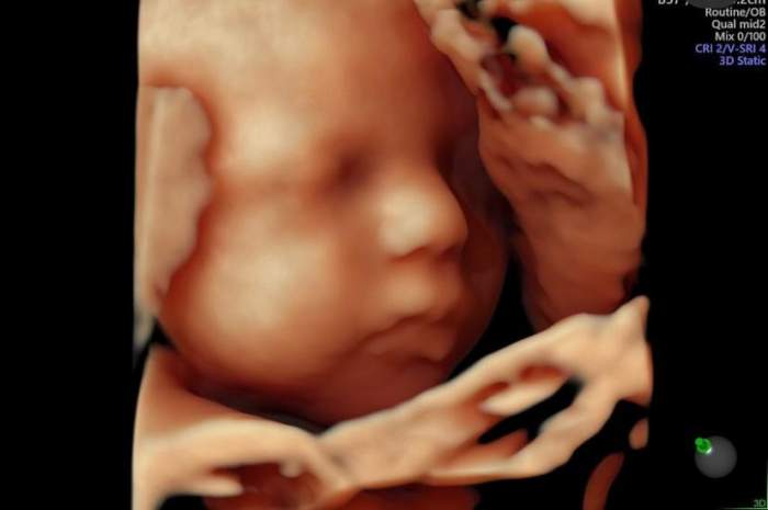 Andreea Popescu, prima imagine cu chipul bebelușului din burtică. Vedeta urmează să devină mamă pentru a treia oară / FOTO