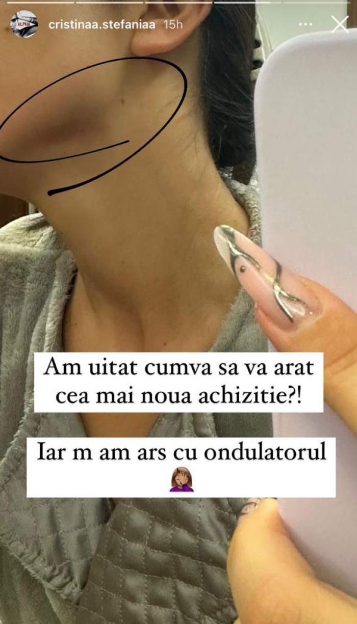 Cristina Ștefania, cu fața arsă! Ce a pățit iubita lui Speak: "Cea mai nouă achiziție” / FOTO