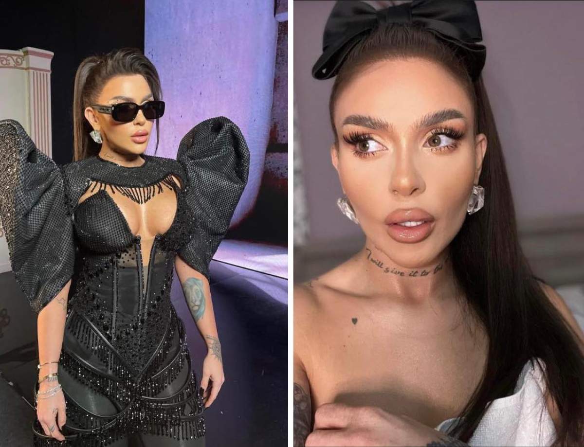 Oana Radu, despre operația la care a fost supusă Oana Radu, despre operația la care a fost supusă