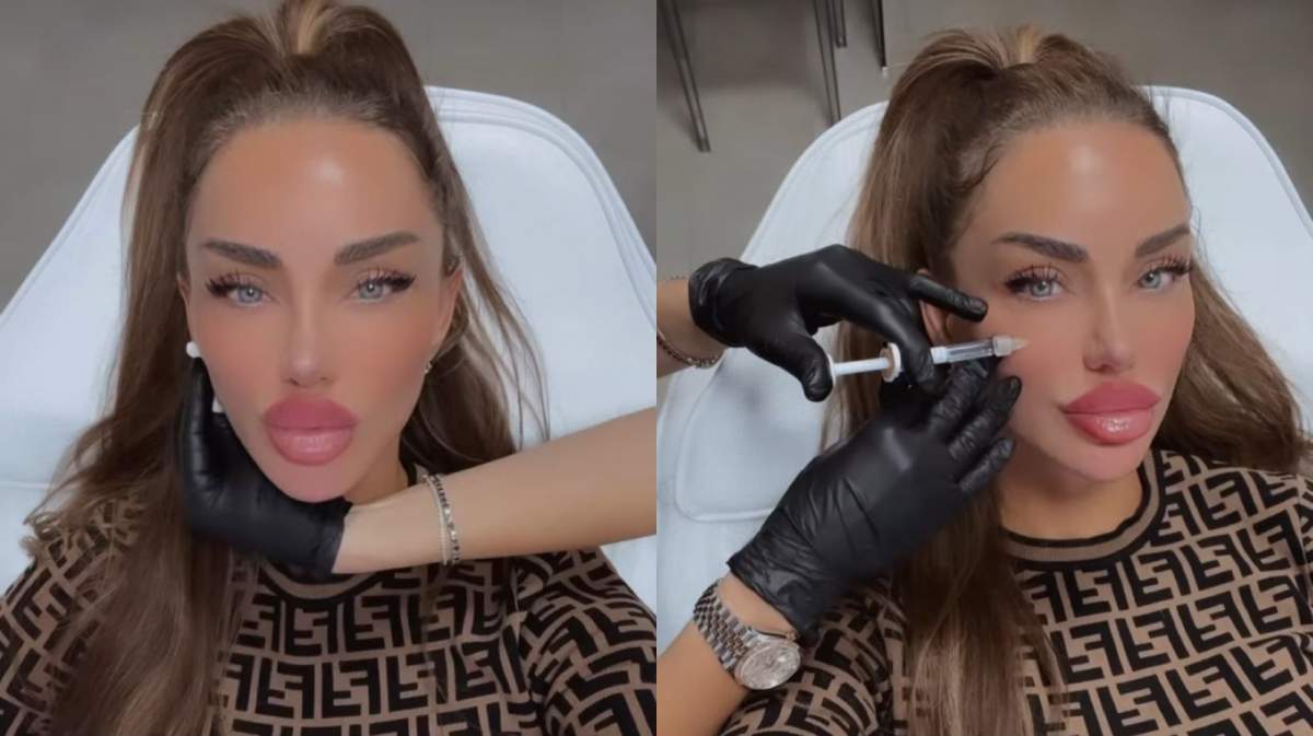 Bianca Drăgușanu, din nou pe mâna medicului estetician! Ce schimbare și-a făcut vedeta: "Am o problemă…” / FOTO