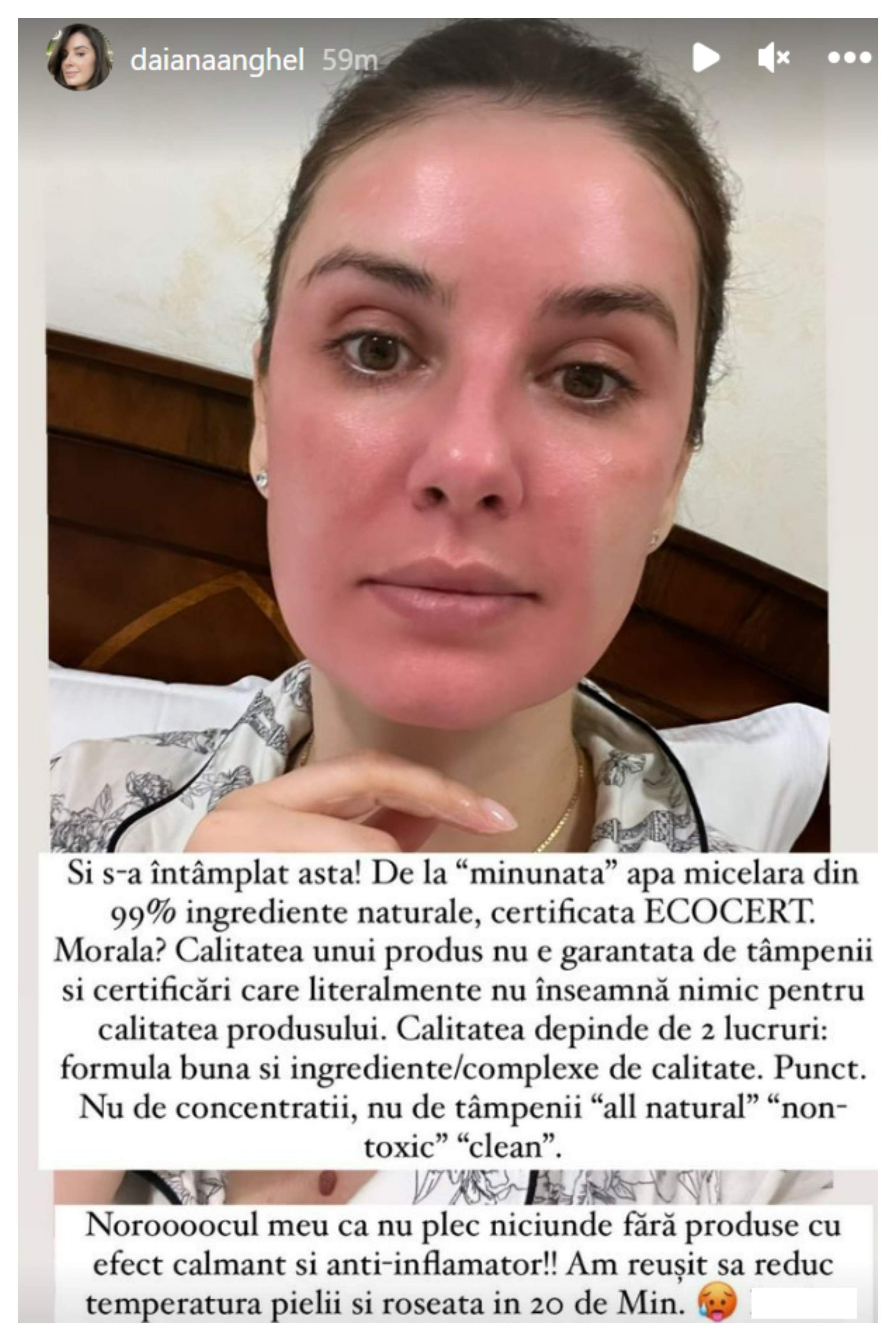 Daiana Anghel și-a șocat fanii în mediul online. Ce a pățit fosta prezentatoare la față / FOTO