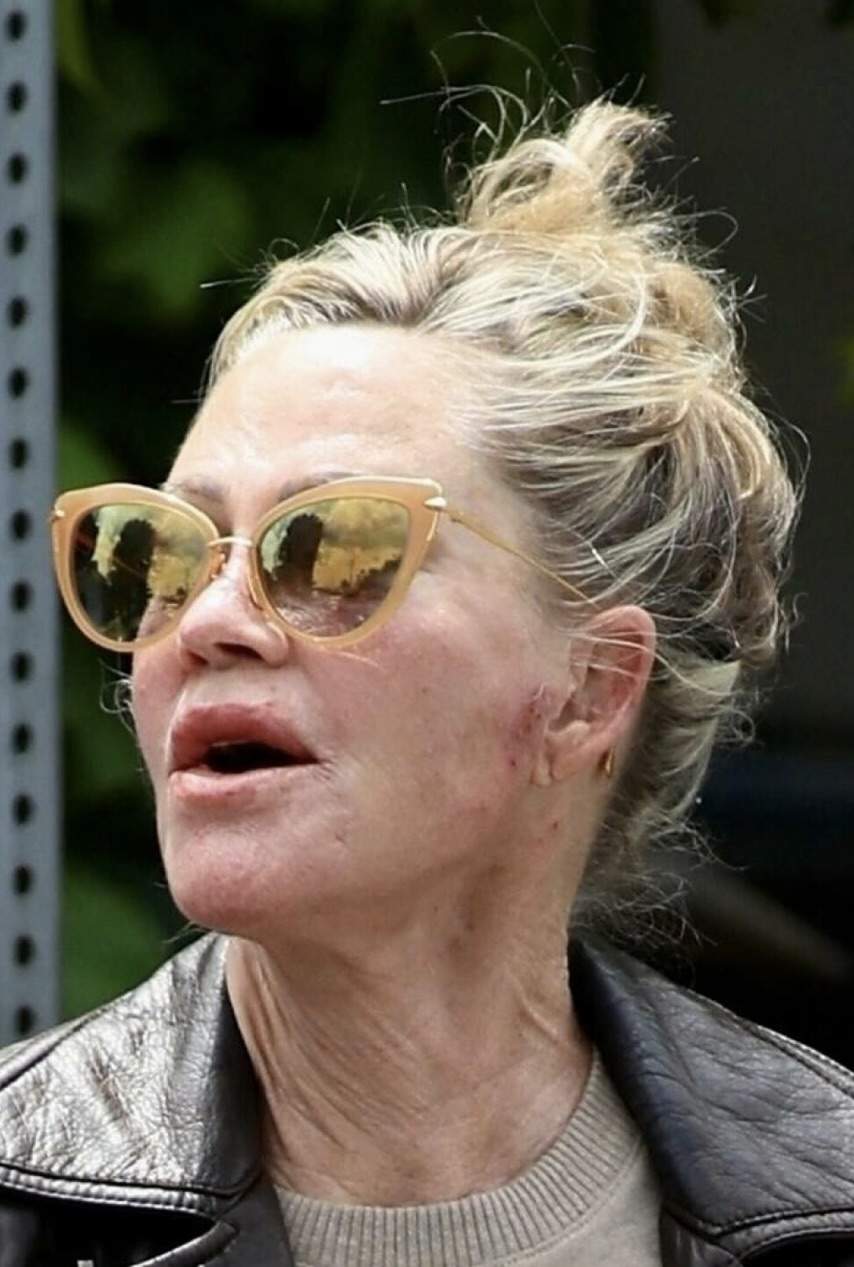 Melanie Griffith, apariție îngrijorătoare. Actrița fost surprinsă cu răni pe față și vânătăi pe mâini / FOTO