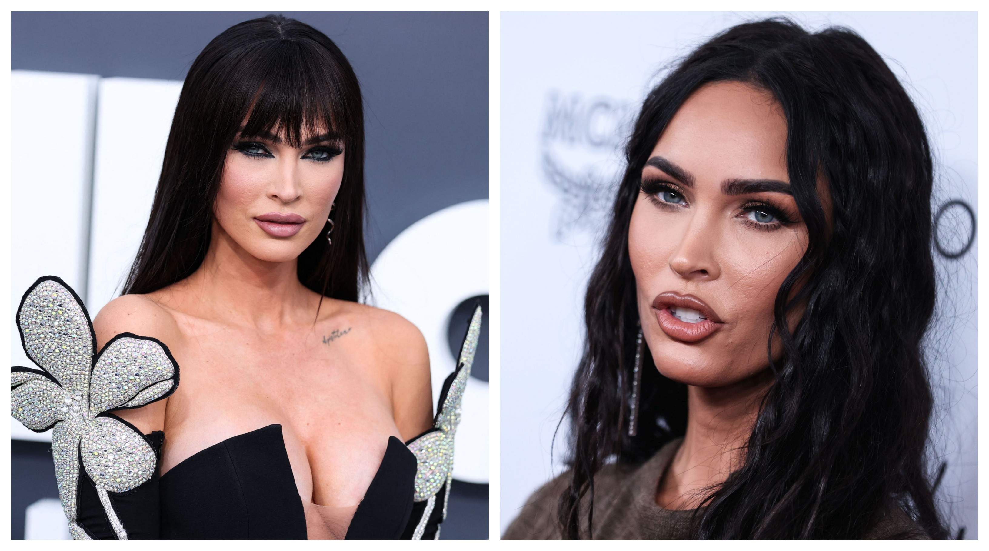 Boala de care suferă Megan Fox. Multe femei se confruntă cu această problemă