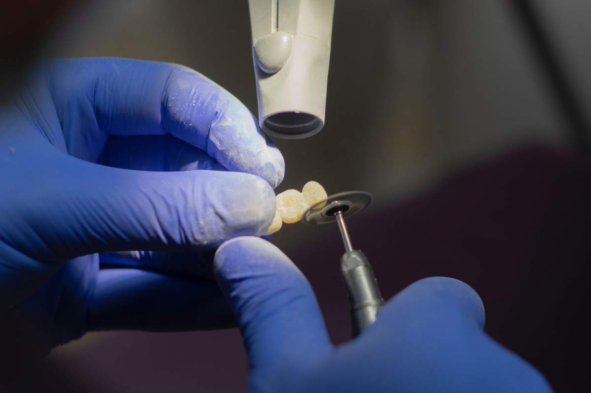 (P) Tarife avantajoase la implant dentar? Află unde poți găsi calitate și prețuri accesibile