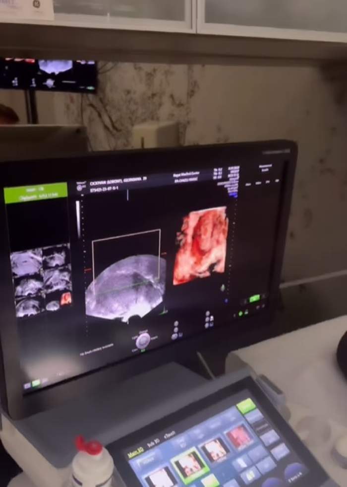 Georgiana Lobonț, prima imagine cu ecografia bebelușului din burtică. Artista va deveni mamă pentru a treia oară anul viitor: "Am trăit o imensă bucurie.." / VIDEO
