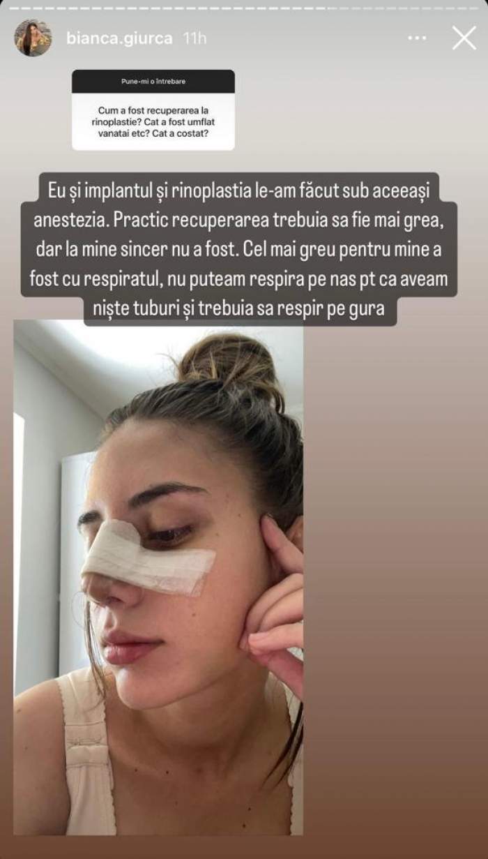 Ce operații estetice are Bianca Giurcă de la Insula Iubirii. Cum arăta concurenta înainte de intervenții: "Cel mai greu pentru mine…” / FOTO