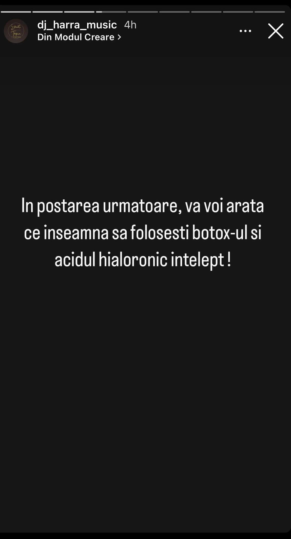 Cum arată DJ Harra înainte de a-și face prima intervenție la nivelul feței. Au trecut 14 ani de atunci: „Ce înseamnă să folosești acidul hialuronic înțelept” / FOTO