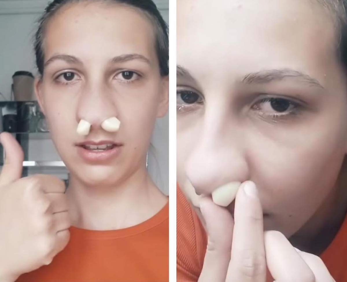 Colaj usturoi în nas Usturoi în nas