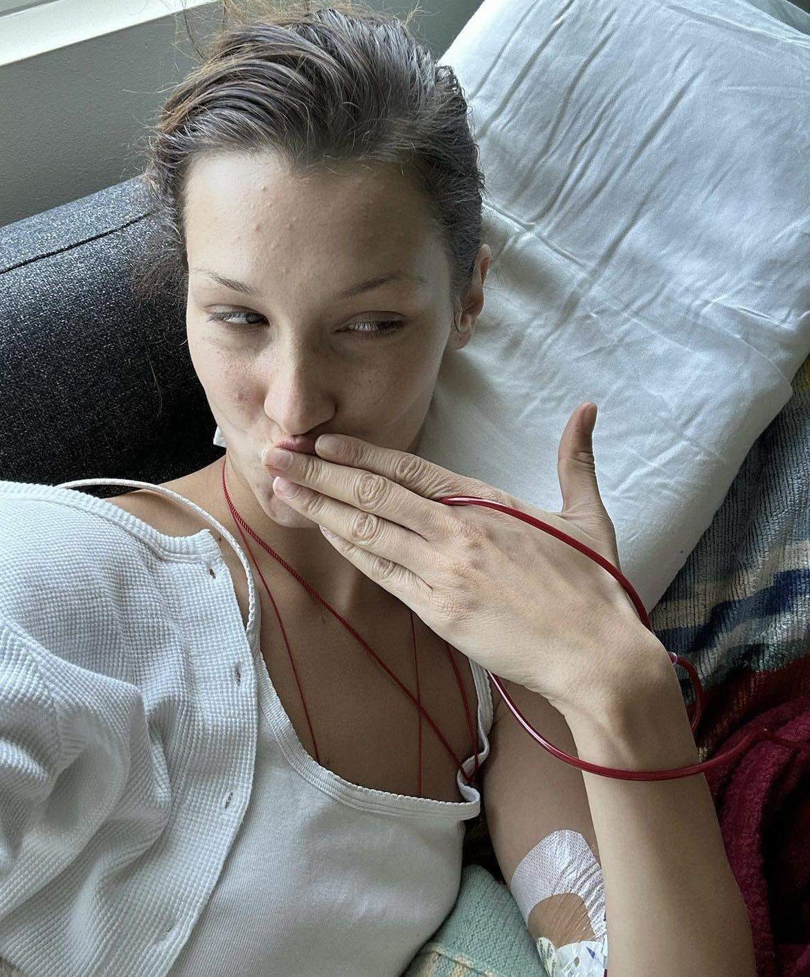 Bella Hadid, detalii halucinante despre starea ei de sănătate. Celebrul model duce o luptă grea de ani de zile: „Atât de tristă și bolnavă” / FOTO