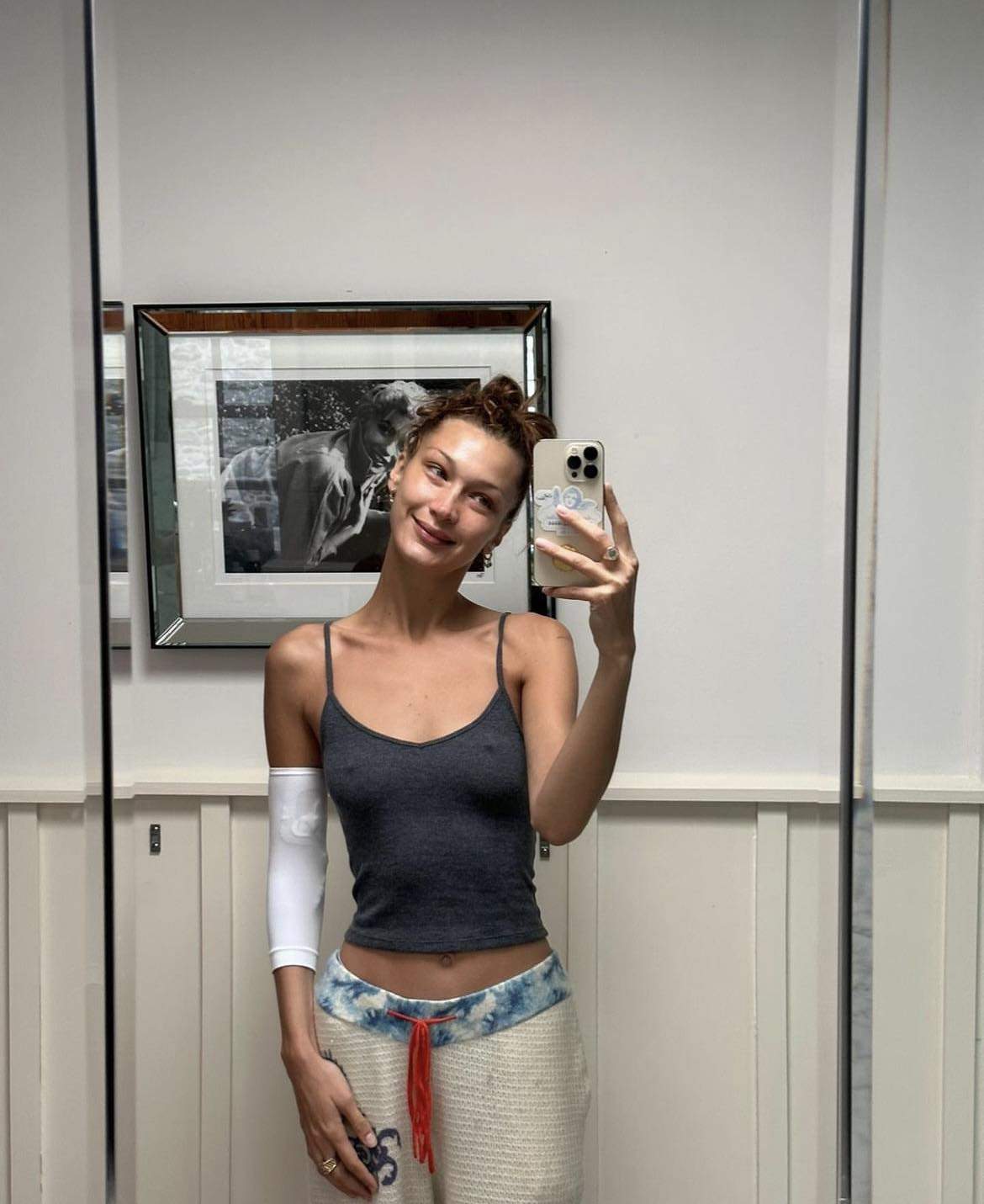 Bella Hadid, detalii halucinante despre starea ei de sănătate. Celebrul model duce o luptă grea de ani de zile: „Atât de tristă și bolnavă” / FOTO