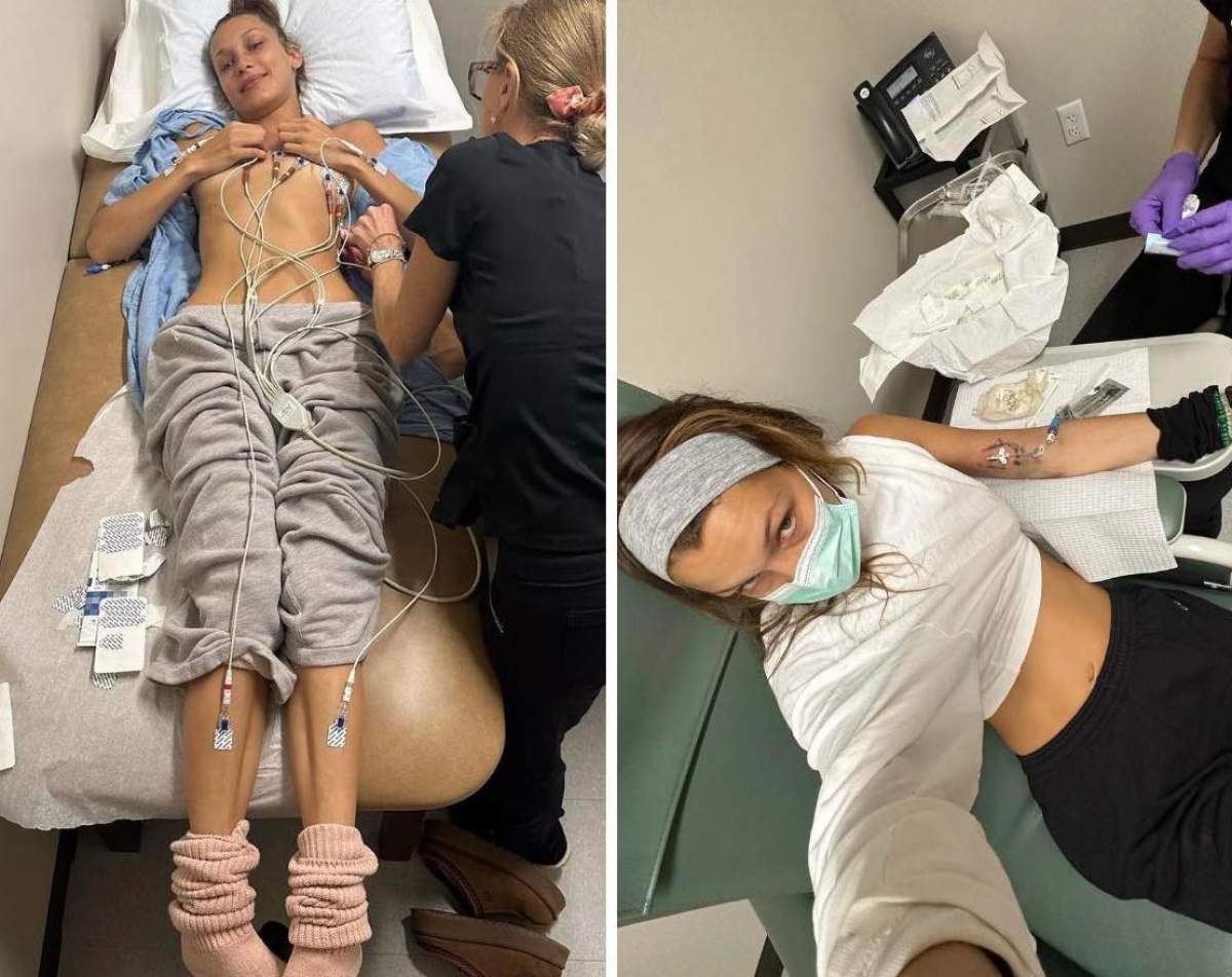 Bella Hadid, detalii despre boala cu care se luptă Bella Hadid, detalii despre boala cu care se luptă