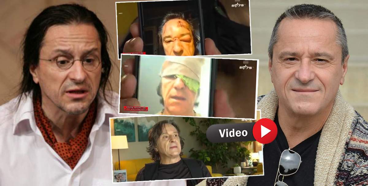 Star Matinal. Claudiu Bleonț, incident la filmări! Imagini incredibile cu actorul cu fața tumefiată / VIDEO