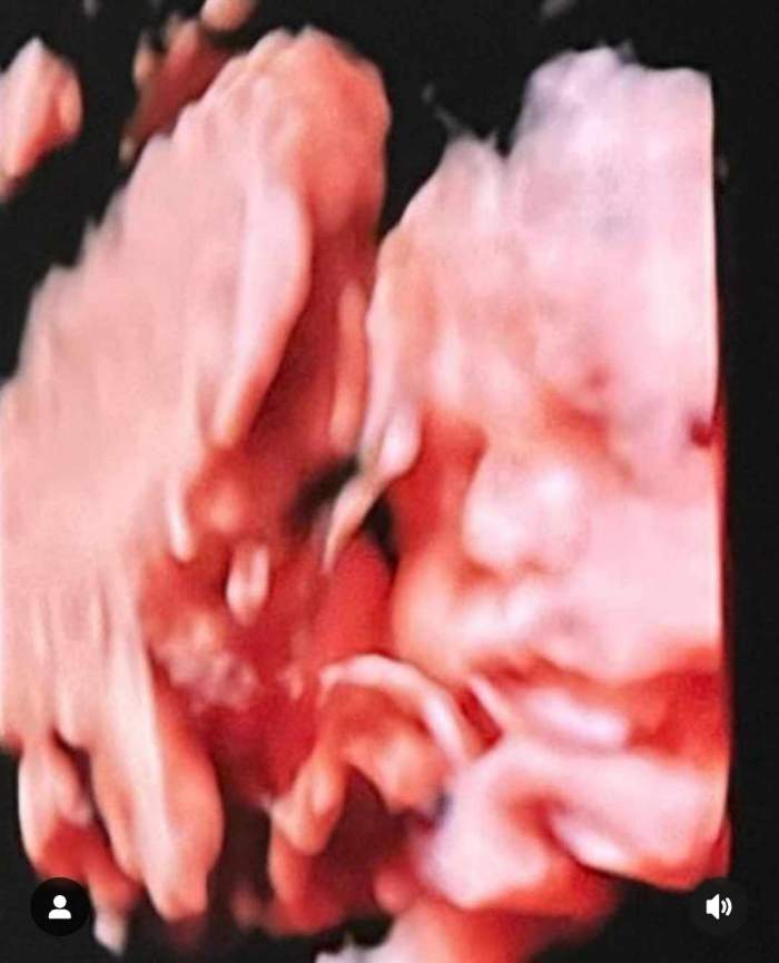 Ema Oprișan, imagine cu ecografia bebelușului din burtică. Concurenta de la Insula Iubirii este foarte fericită / FOTO