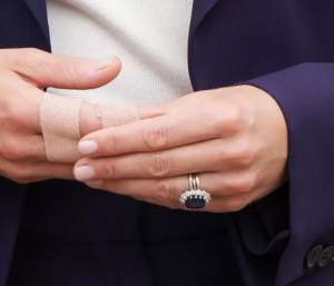 Kate Middleton s-a afișat cu degetele bandajate! Prințesa de Wales și-a îngrijorat fanii / FOTO