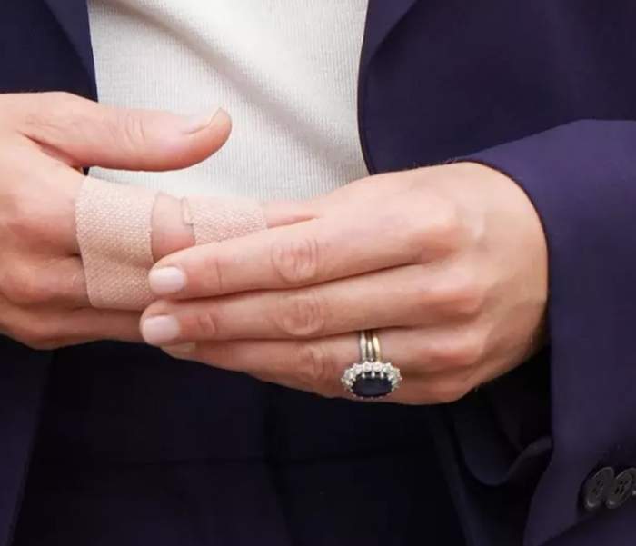 Kate Middleton, cu degetele bandajate