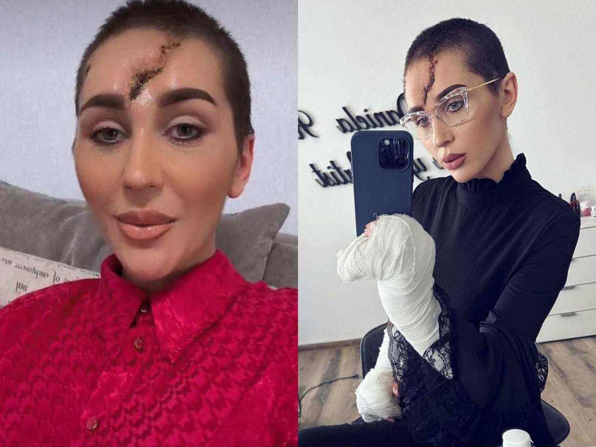 Dana Roba suferă când vede pozele cu ea bătută. Dana Roba