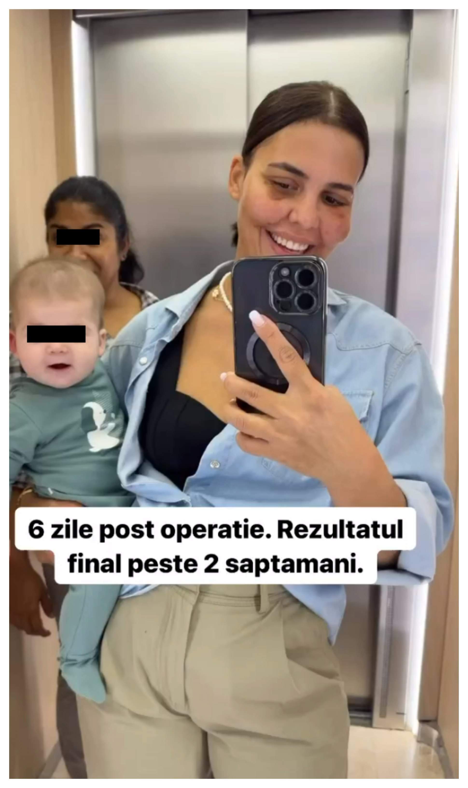 Cum se simte Andreea Popescu după operația de la obraz. Vedeta a trecut prin mai multe intervenții în ultima lună: ”Cicatricile...” / FOTO