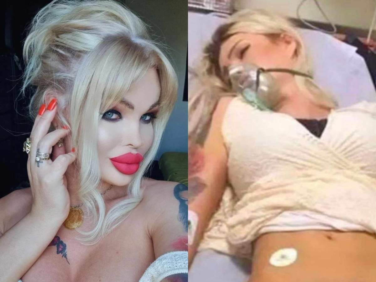 Vedetei i este frică să mai iasă din casă. Lory Loreens machiată și pe patul de spital