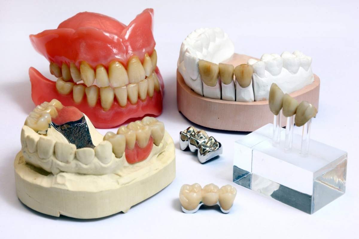 Laborator dentar, tehnician dentar la locul de munca, confectionare punti dentare, proteze dentare, asistenta medicala.