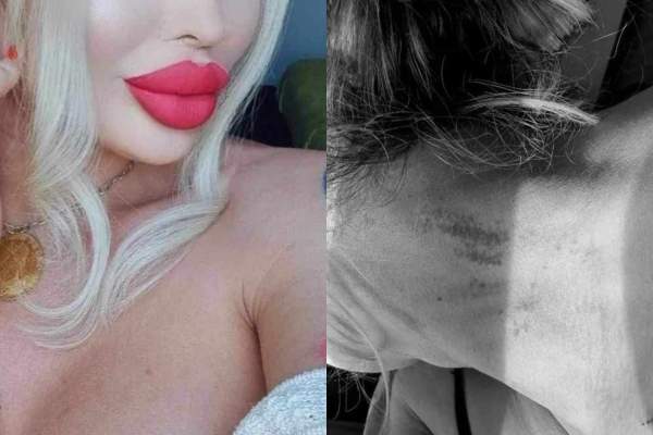 Star Magazin. Vedeta bătută crunt de un bărbat mascat, în București, declarații în lacrimi. Cât de gravă este starea ei de sănătate: ”Mă sufocam, nu aveam aer” / VIDEO