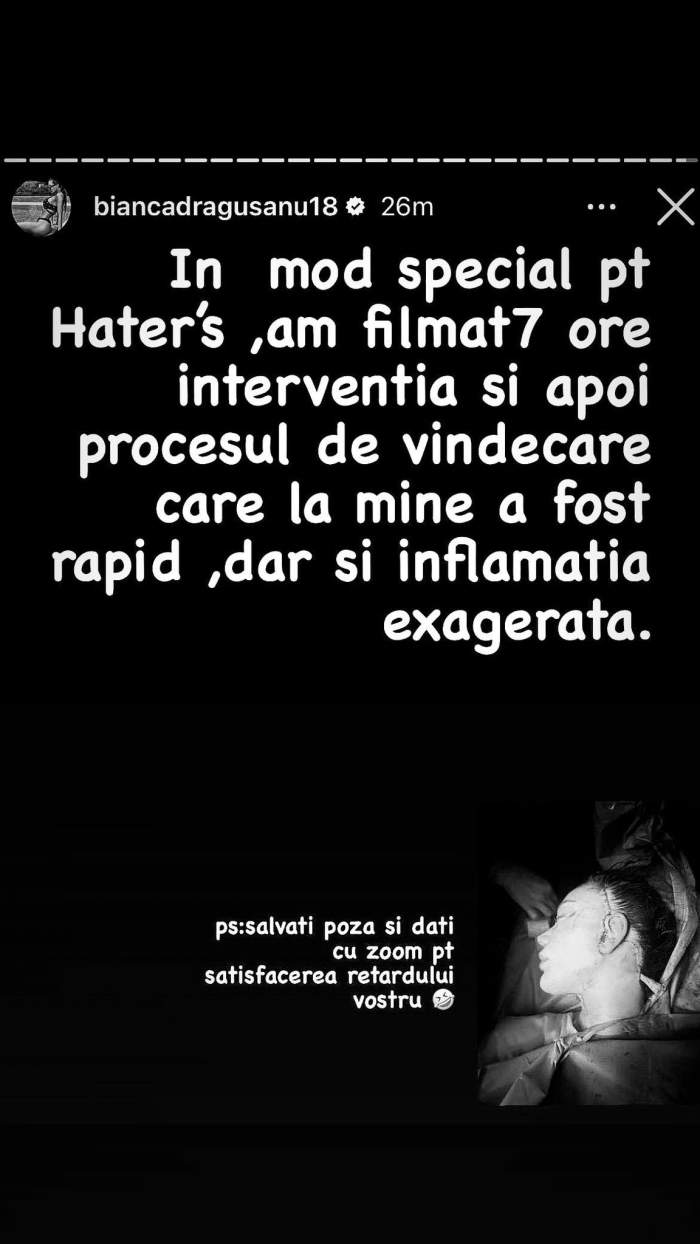 Mesajul postat de Bianca Drăgușanu după intervenția estetică