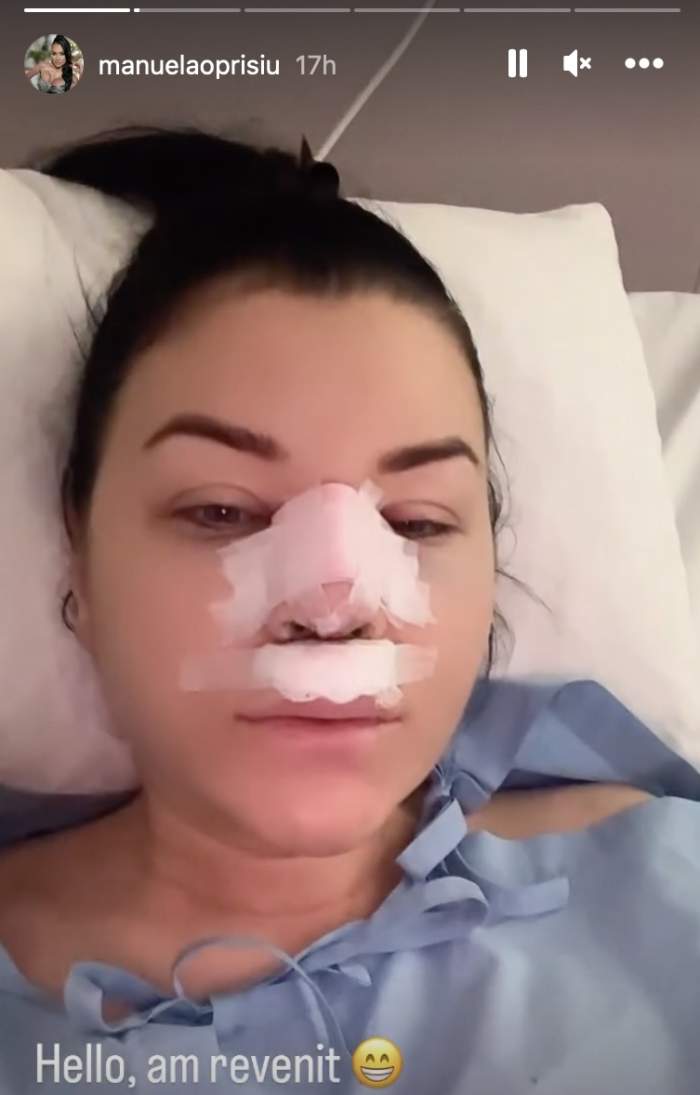 Manuela Oprișiu și-a operat nasul! Cum arată fosta iubită a lui Leo de la Roșiori după intervenția suferită / FOTO