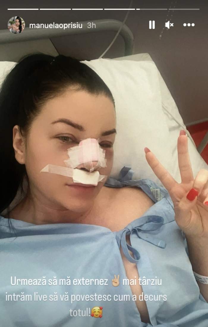 Manuela Oprișiu și-a operat nasul! Cum arată fosta iubită a lui Leo de la Roșiori după intervenția suferită / FOTO